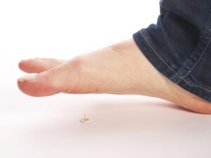 Acupuncture and Peripheral Neuropathy