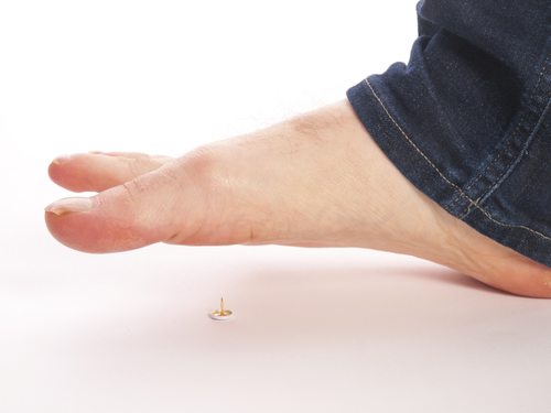 Acupuncture and Peripheral Neuropathy