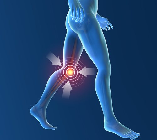 OsteoArthritis without Treatment