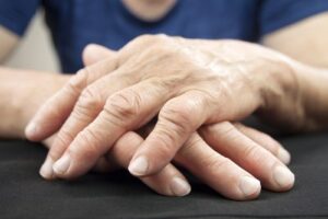 Rheumatoid Arthritis symptoms